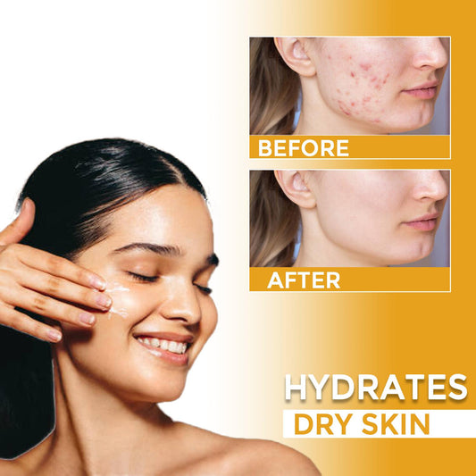 TUMERIC BODY CREAM